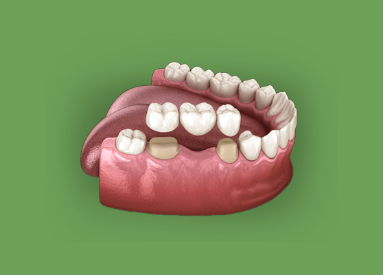 Treatment - Thurmaston Dental Practice