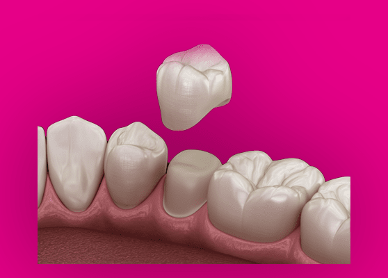 Treatment - Thurmaston Dental Practice